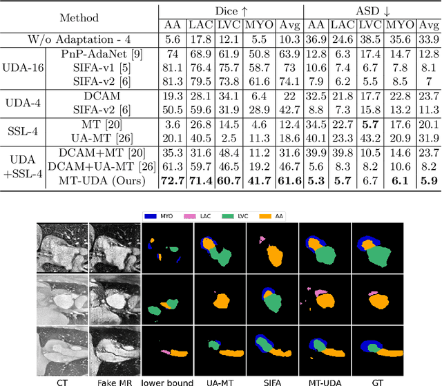 Figure 2 for MT-UDA: Towards Unsupervised Cross-modality Medical Image Segmentation with Limited Source Labels