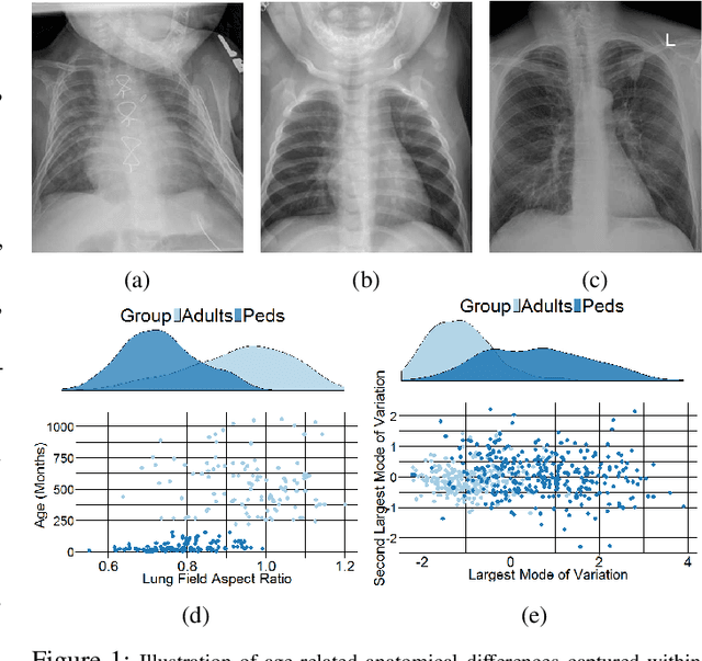 Figure 1 for A Generic Approach to Lung Field Segmentation from Chest Radiographs using Deep Space and Shape Learning