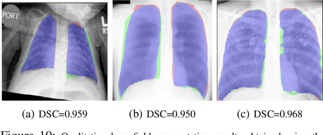 Figure 2 for A Generic Approach to Lung Field Segmentation from Chest Radiographs using Deep Space and Shape Learning