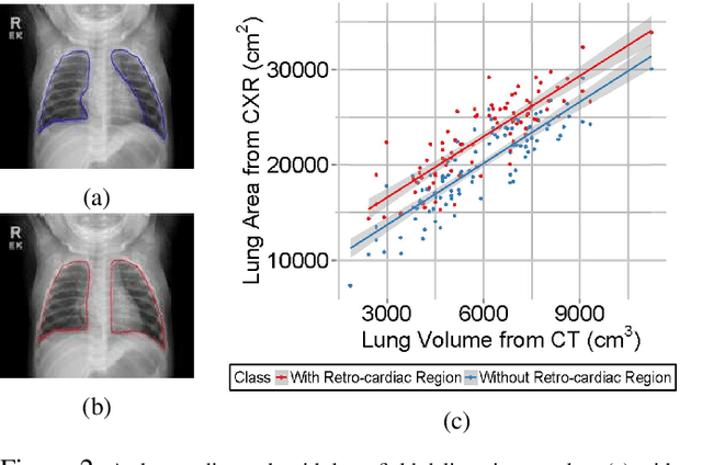 Figure 3 for A Generic Approach to Lung Field Segmentation from Chest Radiographs using Deep Space and Shape Learning
