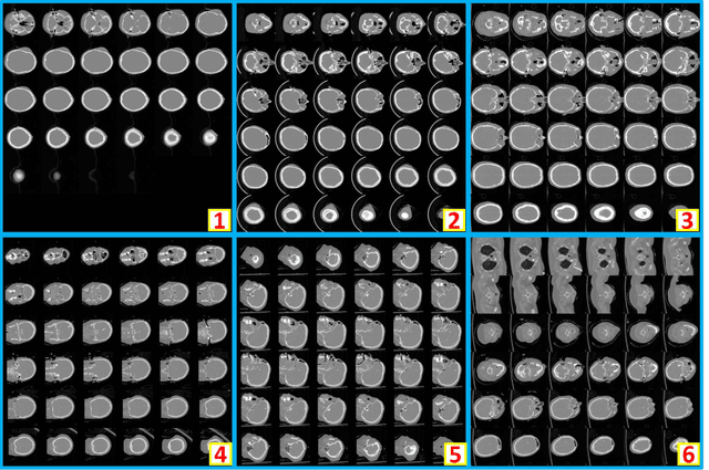Figure 2 for Montage based 3D Medical Image Retrieval from Traumatic Brain Injury Cohort using Deep Convolutional Neural Network
