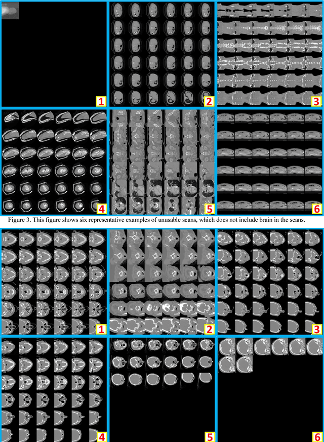 Figure 3 for Montage based 3D Medical Image Retrieval from Traumatic Brain Injury Cohort using Deep Convolutional Neural Network