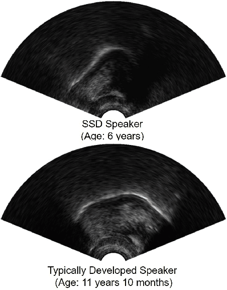 Figure 1 for Convolutional Neural Network-Based Age Estimation Using B-Mode Ultrasound Tongue Image