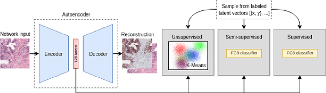 Figure 1 for Dealing with Label Scarcity in Computational Pathology: A Use Case in Prostate Cancer Classification