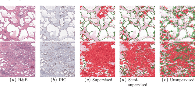 Figure 2 for Dealing with Label Scarcity in Computational Pathology: A Use Case in Prostate Cancer Classification