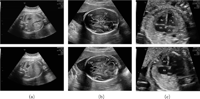 Figure 2 for Automatic quality assessment for 2D fetal sonographic standard plane based on multi-task learning