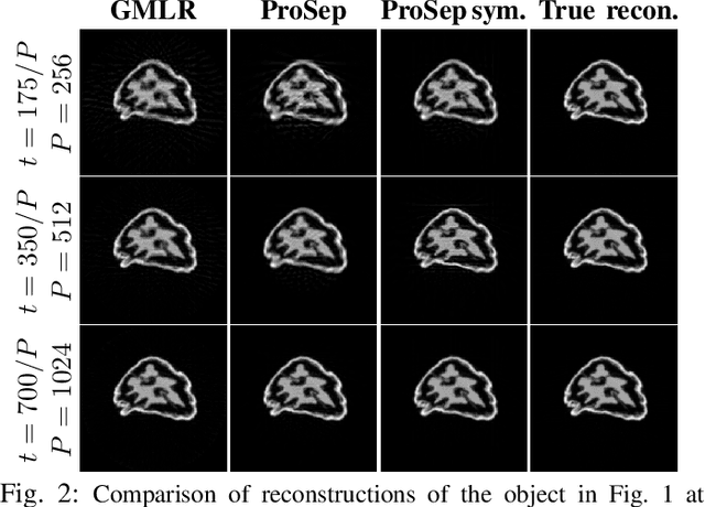 Figure 2 for Dynamic Tomography Reconstruction by Projection-Domain Separable Modeling