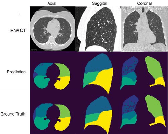 Figure 3 for Automatic Pulmonary Lobe Segmentation Using Deep Learning