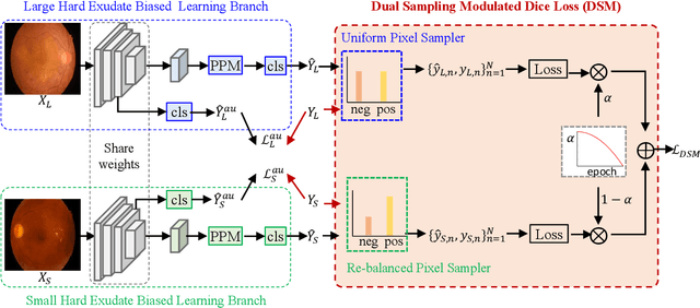 Figure 3 for Dual-Branch Network with Dual-Sampling Modulated Dice Loss for Hard Exudate Segmentation from Colour Fundus Images