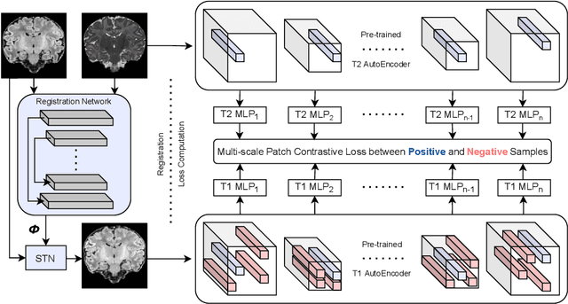 Figure 1 for ContraReg: Contrastive Learning of Multi-modality Unsupervised Deformable Image Registration