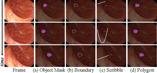 Figure 2 for Video Polyp Segmentation: A Deep Learning Perspective