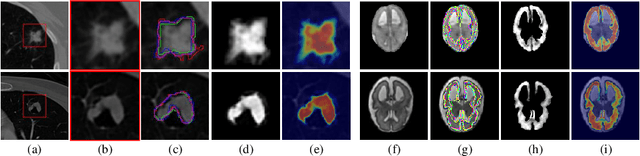 Figure 1 for Medical Matting: A New Perspective on Medical Segmentation with Uncertainty