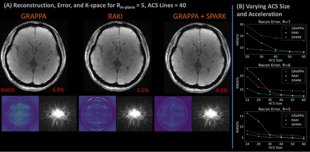 Figure 3 for Scan Specific Artifact Reduction in K-space (SPARK) Neural Networks Synergize with Physics-based Reconstruction to Accelerate MRI