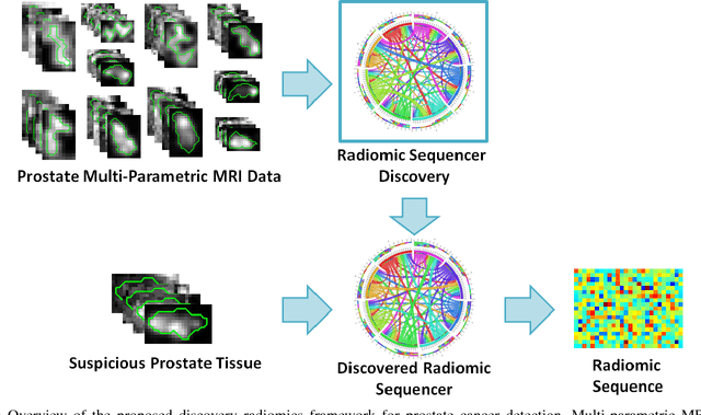 Figure 1 for Discovery Radiomics for Multi-Parametric MRI Prostate Cancer Detection