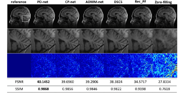 Figure 3 for Model Learning: Primal Dual Networks for Fast MR imaging