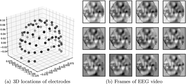 Figure 1 for Multimodal Classification with Deep Convolutional-Recurrent Neural Networks for Electroencephalography