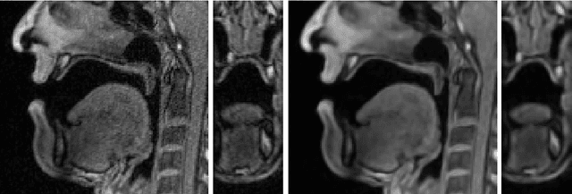 Figure 1 for A Multilinear Tongue Model Derived from Speech Related MRI Data of the Human Vocal Tract
