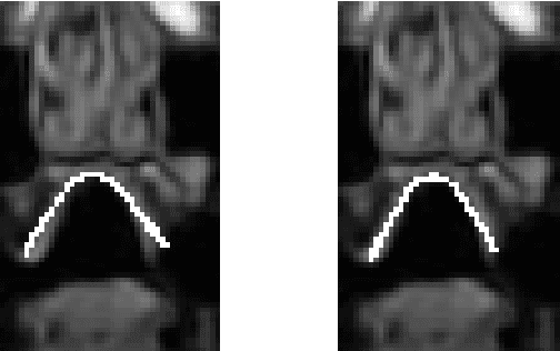 Figure 3 for A Multilinear Tongue Model Derived from Speech Related MRI Data of the Human Vocal Tract