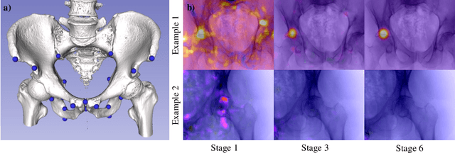 Figure 2 for X-ray-transform Invariant Anatomical Landmark Detection for Pelvic Trauma Surgery