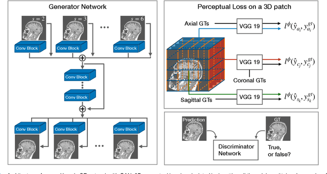 Figure 1 for SOUP-GAN: Super-Resolution MRI Using Generative Adversarial Networks