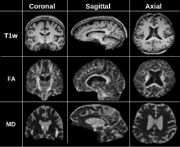 Figure 1 for Input Agnostic Deep Learning for Alzheimer's Disease Classification Using Multimodal MRI Images