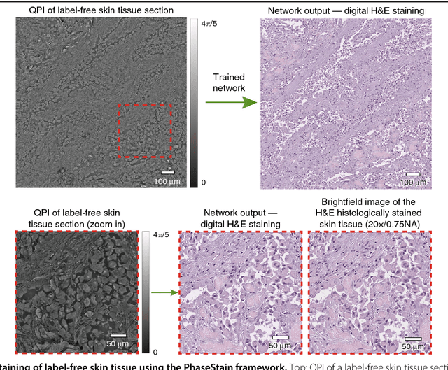 Figure 3 for PhaseStain: Digital staining of label-free quantitative phase microscopy images using deep learning