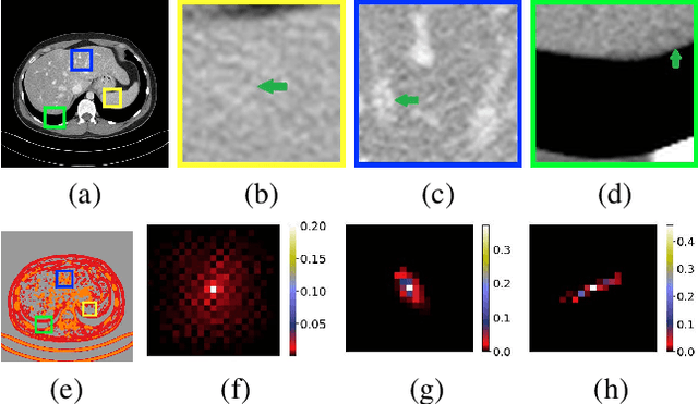 Figure 2 for Low-Dose CT Denoising Using a Structure-Preserving Kernel Prediction Network