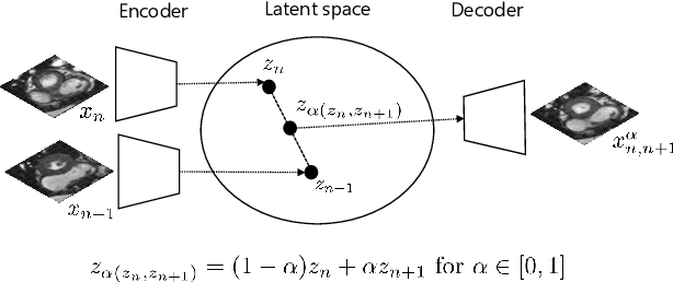 Figure 1 for Autoencoding Low-Resolution MRI for Semantically Smooth Interpolation of Anisotropic MRI