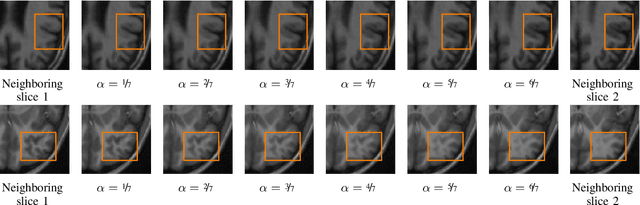 Figure 3 for Autoencoding Low-Resolution MRI for Semantically Smooth Interpolation of Anisotropic MRI