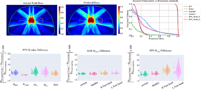 Figure 3 for Site-Agnostic 3D Dose Distribution Prediction with Deep Learning Neural Networks