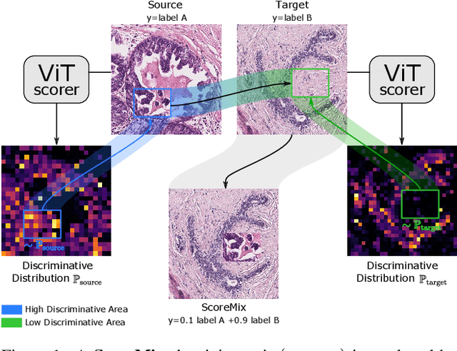 Figure 1 for ScoreNet: Learning Non-Uniform Attention and Augmentation for Transformer-Based Histopathological Image Classification