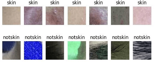 Figure 3 for An Automatic Diagnosis Method of Facial Acne Vulgaris Based on Convolutional Neural Network