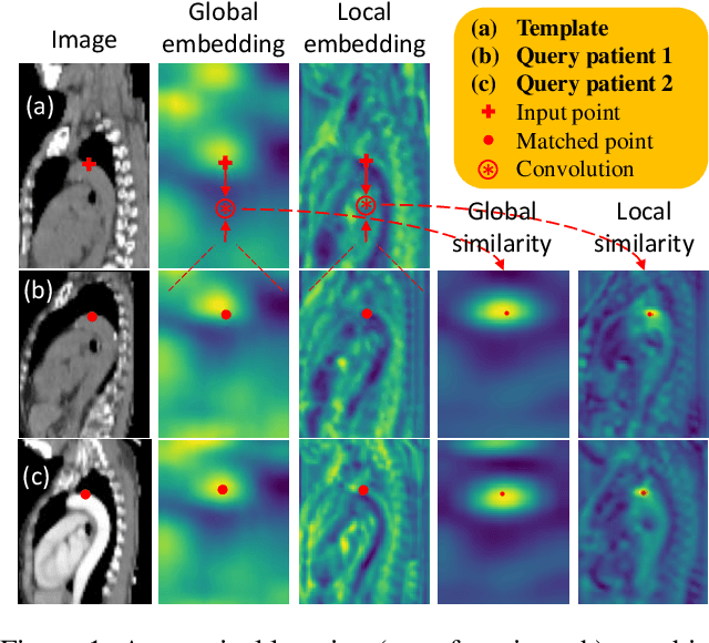 Figure 1 for Self-supervised Learning of Pixel-wise Anatomical Embeddings in Radiological Images