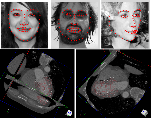 Figure 1 for Globally Tuned Cascade Pose Regression via Back Propagation with Application in 2D Face Pose Estimation and Heart Segmentation in 3D CT Images