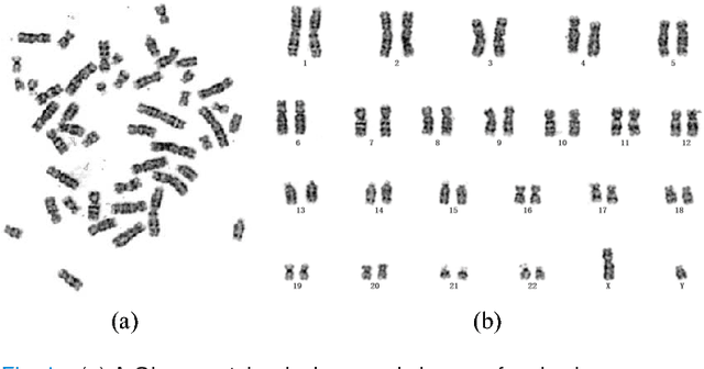 Figure 1 for Varifocal-Net: A Chromosome Classification Approach using Deep Convolutional Networks
