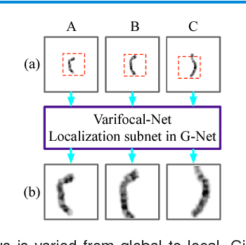 Figure 4 for Varifocal-Net: A Chromosome Classification Approach using Deep Convolutional Networks