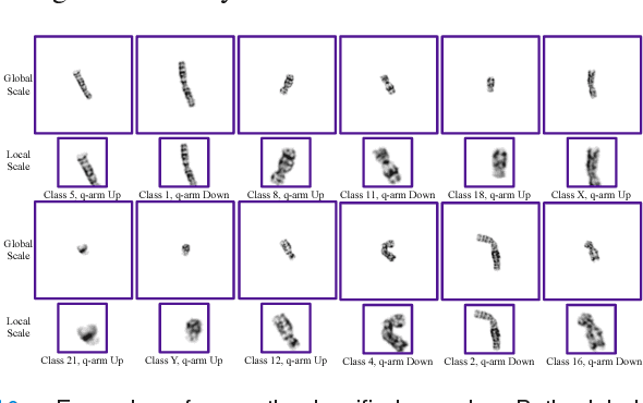 Figure 2 for Varifocal-Net: A Chromosome Classification Approach using Deep Convolutional Networks