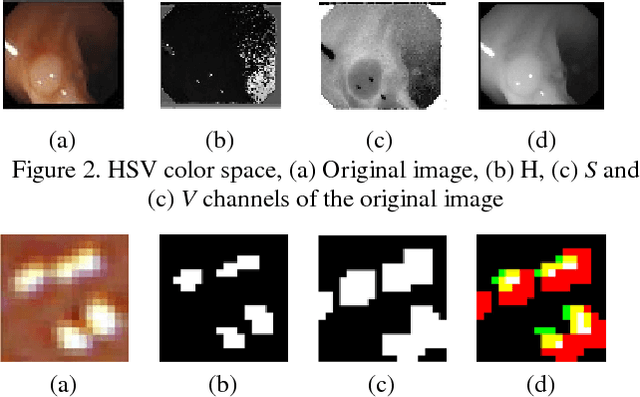 Figure 2 for Adaptive specular reflection detection and inpainting in colonoscopy video frames