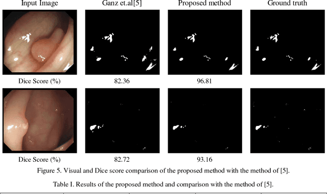 Figure 4 for Adaptive specular reflection detection and inpainting in colonoscopy video frames