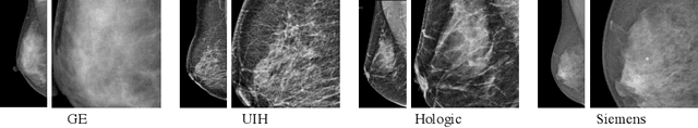 Figure 1 for Domain Generalization for Mammography Detection via Multi-style and Multi-view Contrastive Learning
