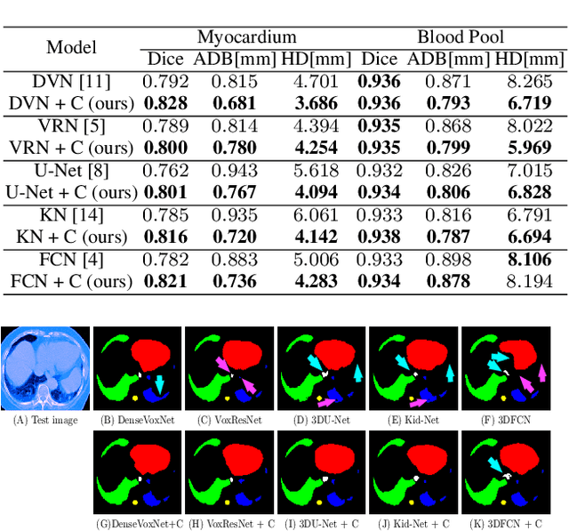 Figure 4 for Cascade Decoder: A Universal Decoding Method for Biomedical Image Segmentation