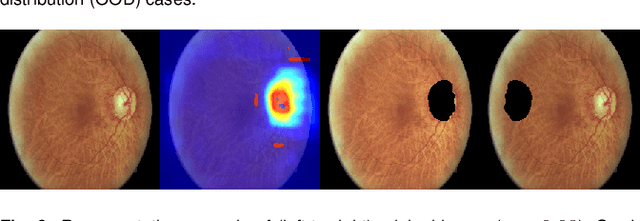 Figure 3 for Deep Dirichlet uncertainty for unsupervised out-of-distribution detection of eye fundus photographs in glaucoma screening