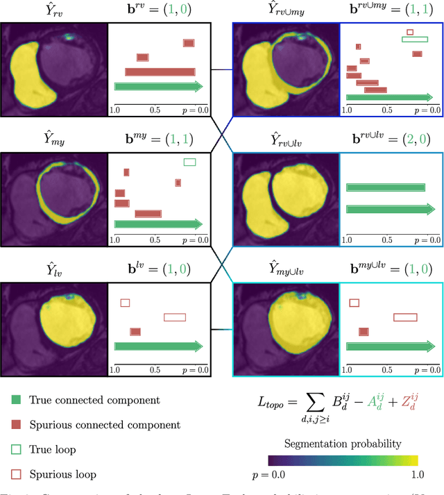 Figure 3 for A persistent homology-based topological loss function for multi-class CNN segmentation of cardiac MRI