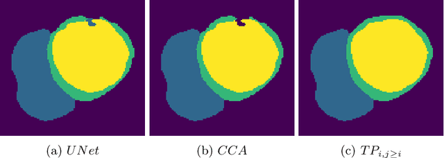 Figure 4 for A persistent homology-based topological loss function for multi-class CNN segmentation of cardiac MRI