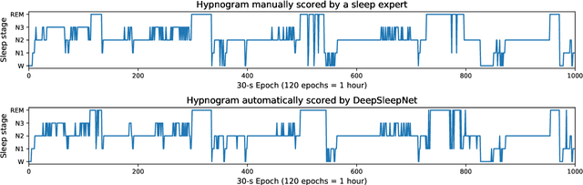 Figure 2 for DeepSleepNet: a Model for Automatic Sleep Stage Scoring based on Raw Single-Channel EEG