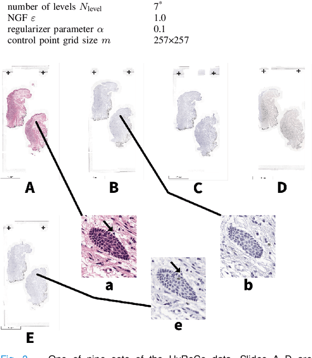 Figure 3 for High-resolution Image Registration of Consecutive and Re-stained Sections in Histopathology