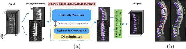Figure 1 for Btrfly Net: Vertebrae Labelling with Energy-based Adversarial Learning of Local Spine Prior