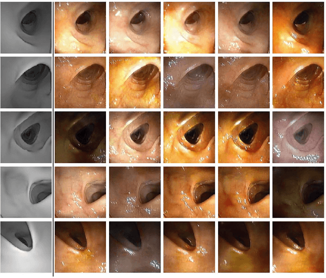 Figure 2 for CLTS-GAN: Color-Lighting-Texture-Specular Reflection Augmentation for Colonoscopy