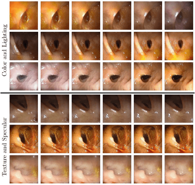 Figure 3 for CLTS-GAN: Color-Lighting-Texture-Specular Reflection Augmentation for Colonoscopy