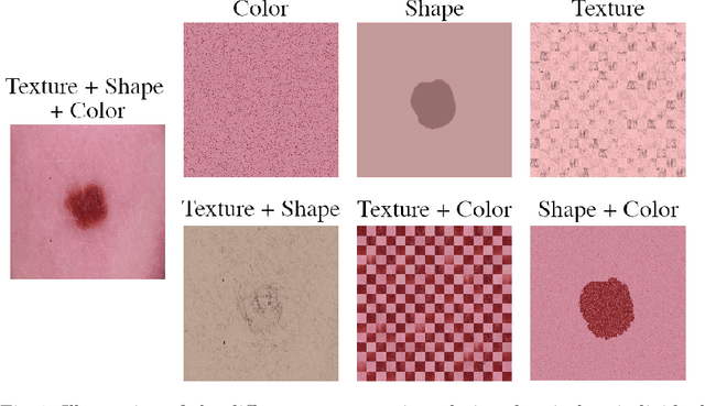 Figure 1 for Revisiting the Shape-Bias of Deep Learning for Dermoscopic Skin Lesion Classification